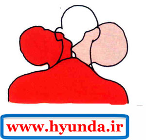حرکات گردن در تصادف از بغل